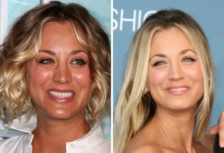 Kaley Cuoco nose job