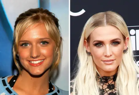ashlee simpson nose job
