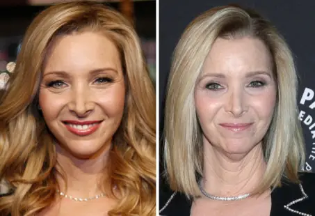 lisa kudrow nose job