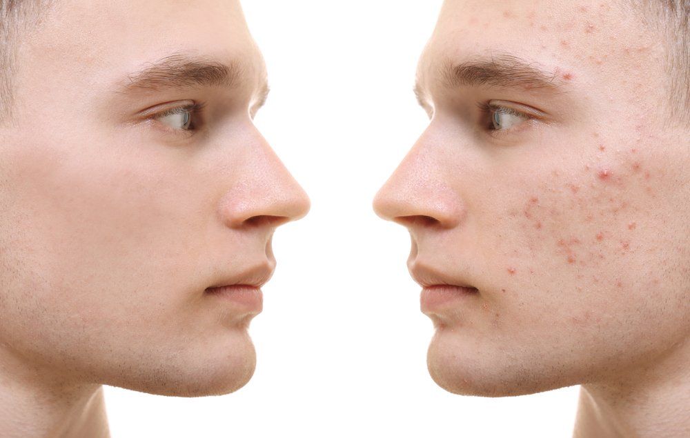 face scar