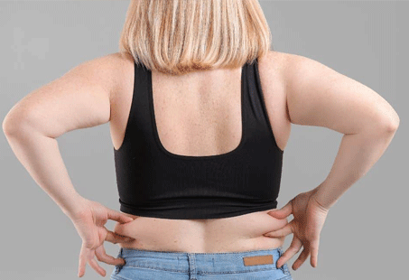 love handles