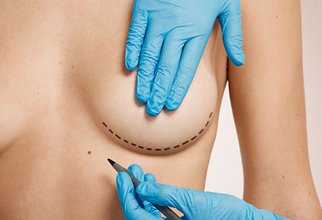 boob job scars
