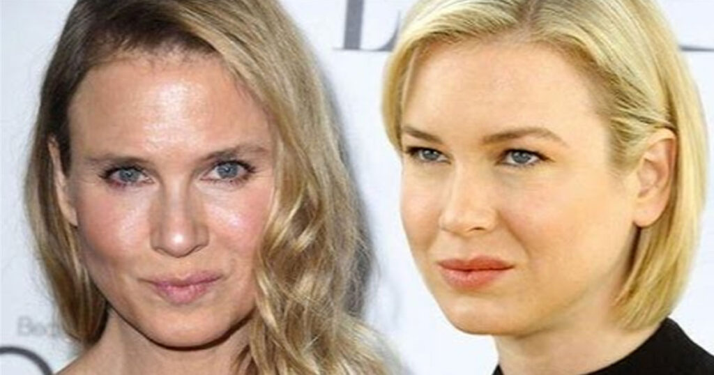 renee before and after