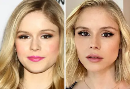 erin moriarty blepharoplasty