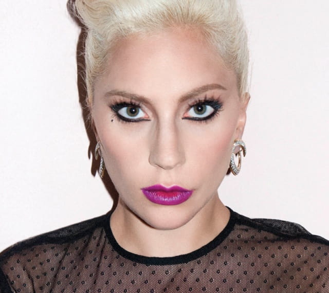Lady gaga Botox and fillers