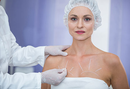 breast thread lift