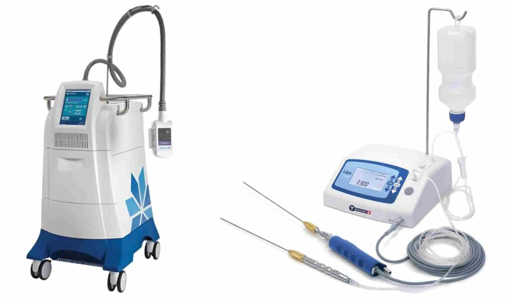 Coolsculpting vs liposuction 1 1