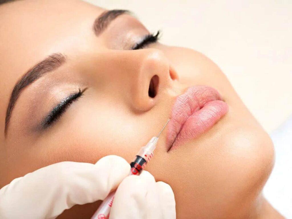 Lip injections