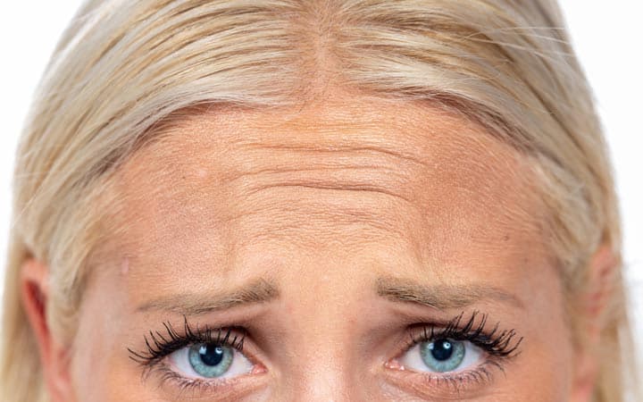 Frown lines