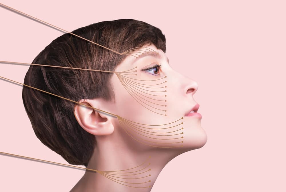 Thread lift