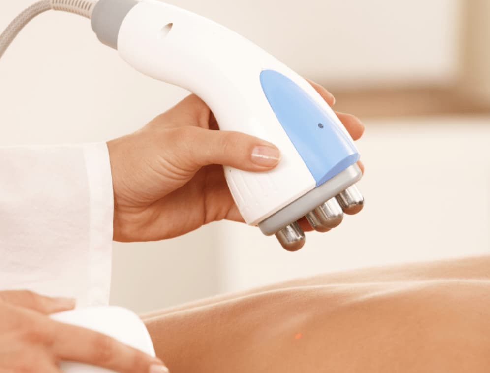 RF therapy
