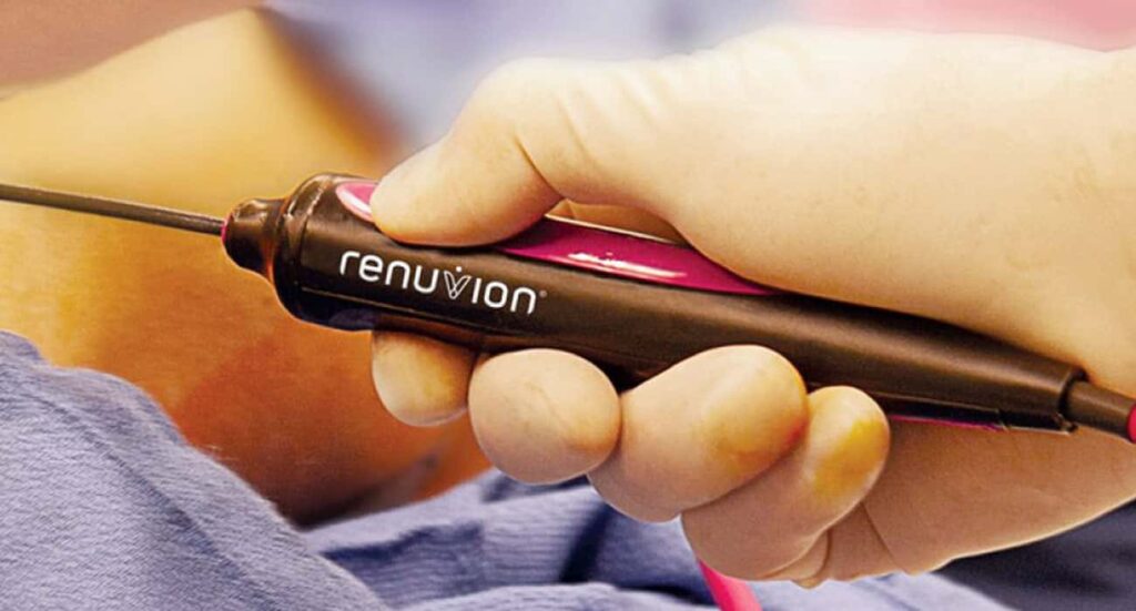 Renuvion