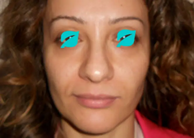 Hollow temples