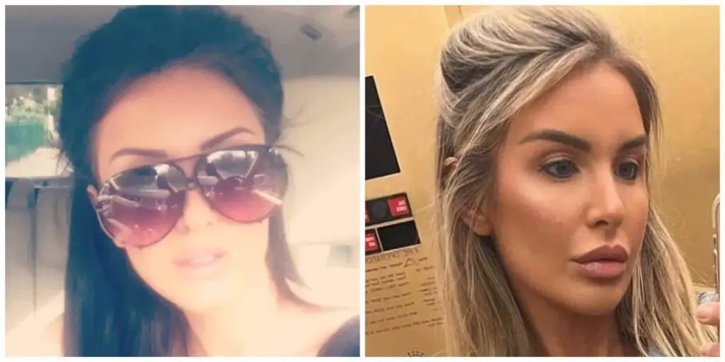 Mafs Peggy Rose brow lift