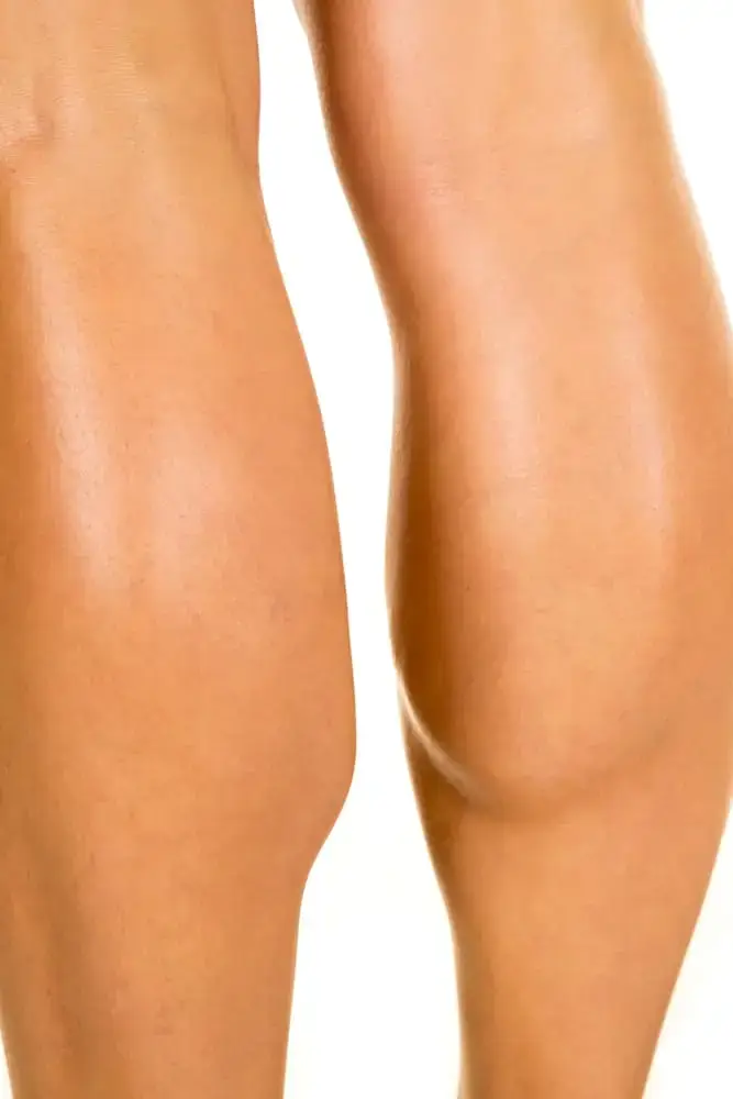 Womans calves