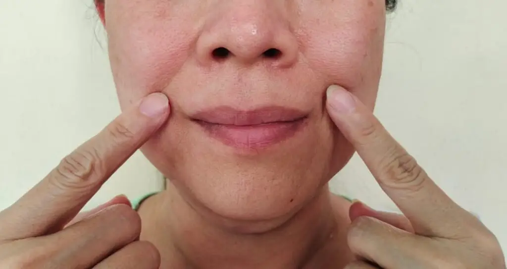 Nasolabial folds