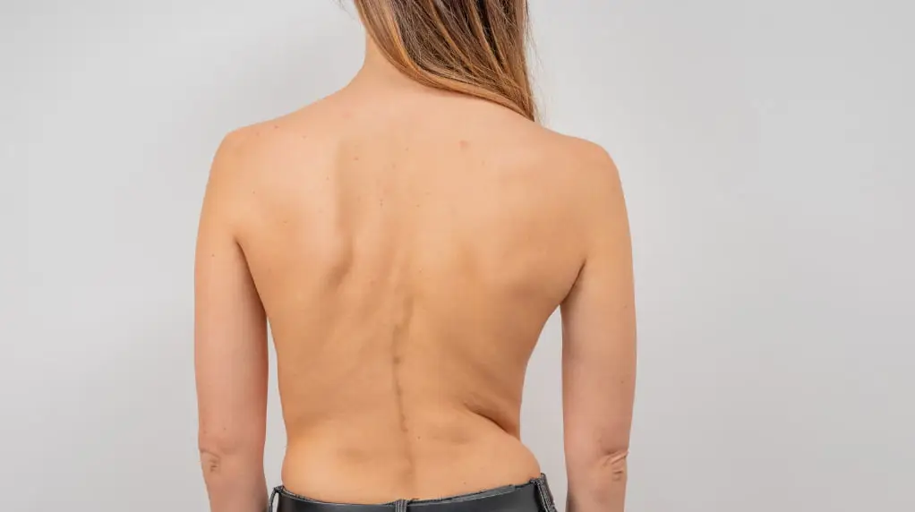 bare back