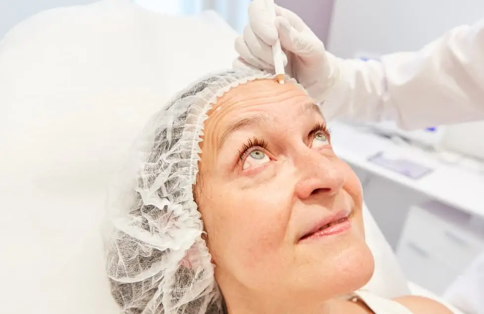 face surgery