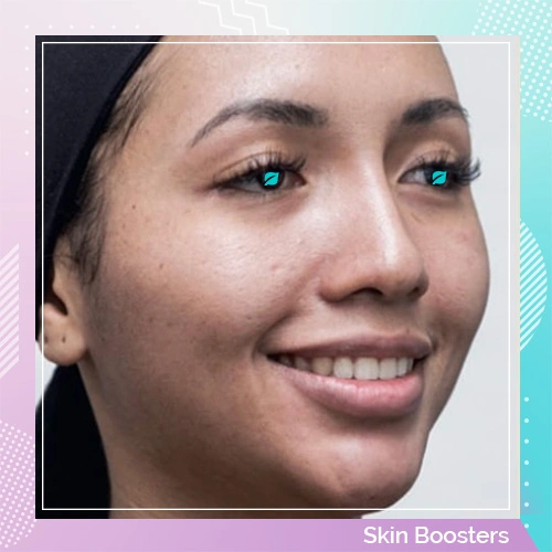 Skin Booster patient after 1