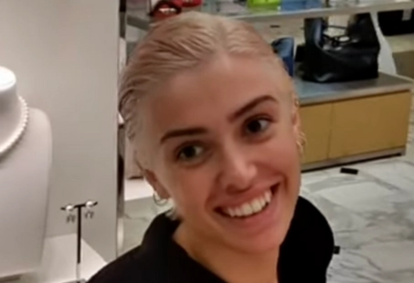 Bianca Censori Plastic Surgery