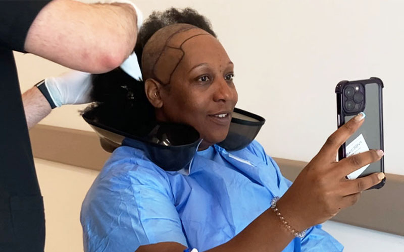 Afro Hair Transplant Patient.jpg