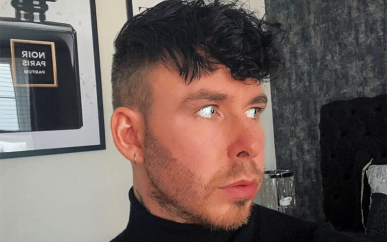 Beard Transplant Patient.jpg