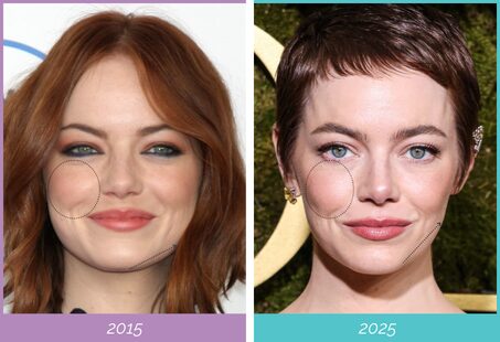 Emma stone facial transformation