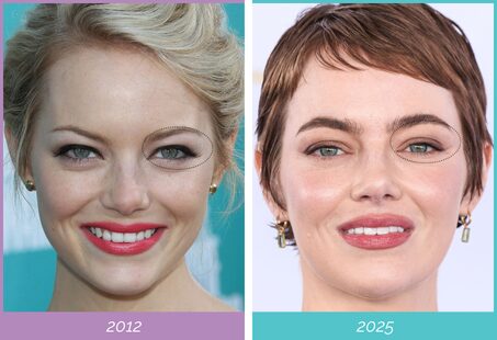 Emma stone transformation