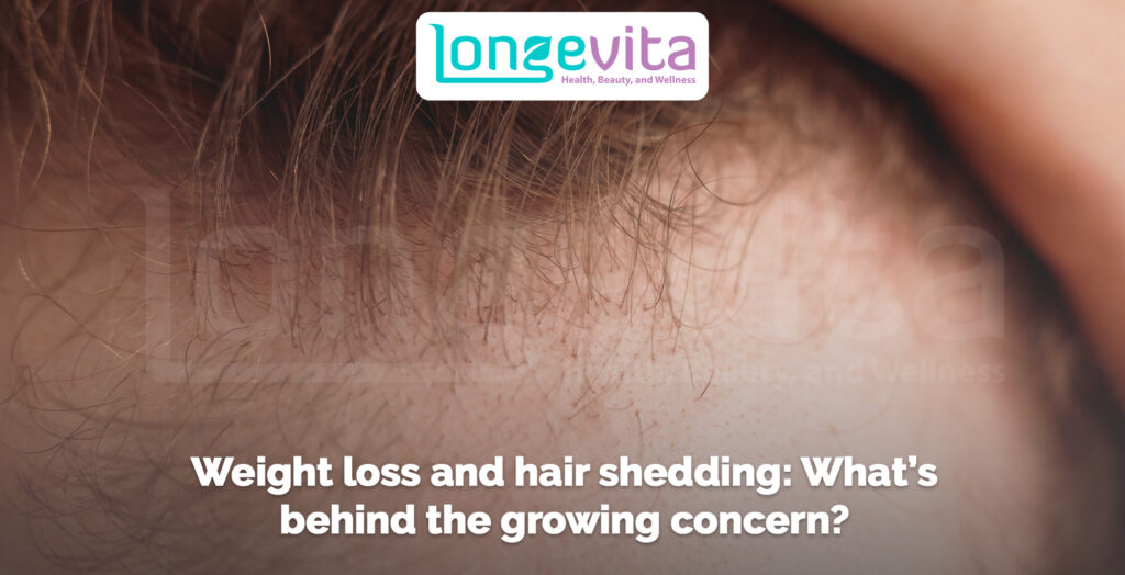 mounjaro hair loss longevita