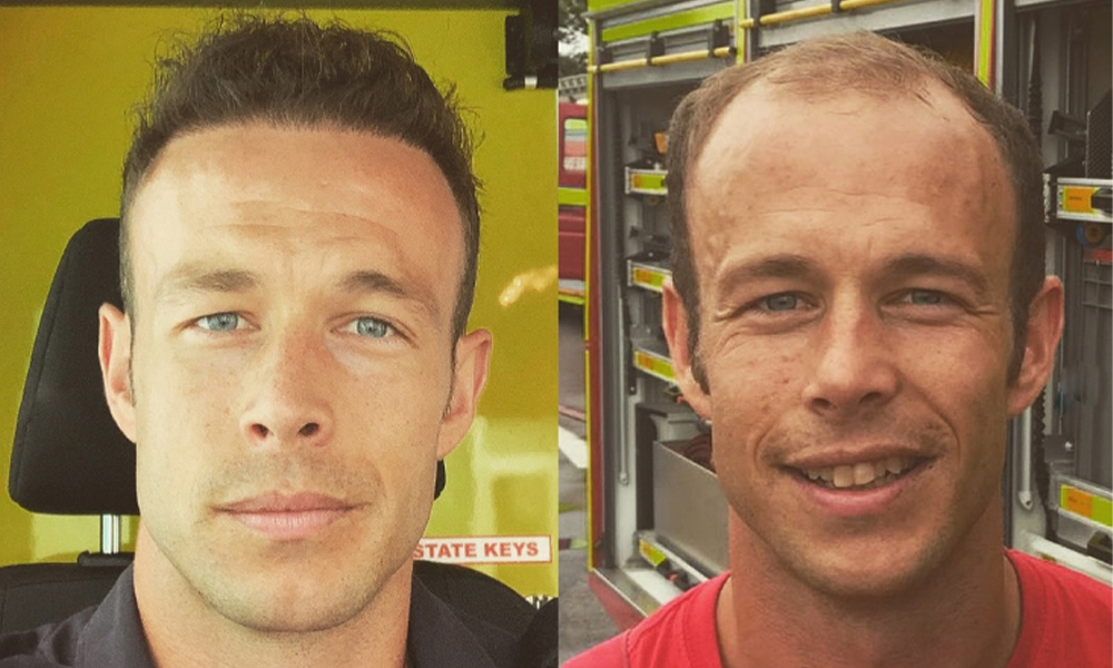 christopher before after