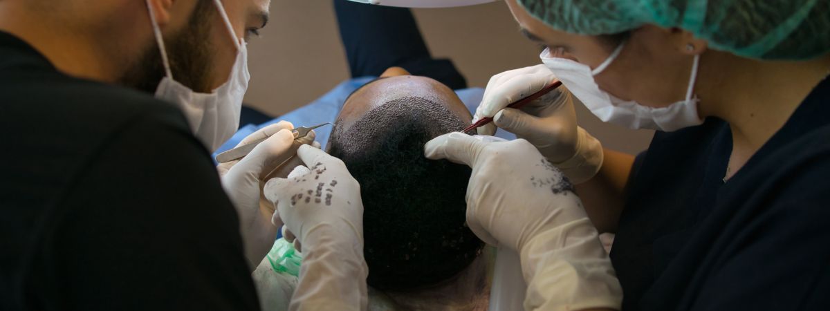 hair transplant uk graft incision