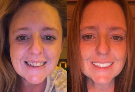 Gillian patient story