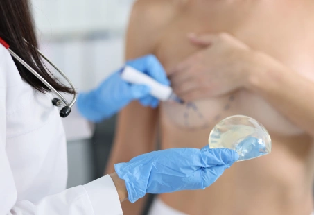 Over The Muscle Vs Under The Muscle Breast Implants[1]