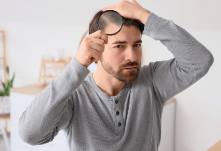 can you prevent wegovy hair loss