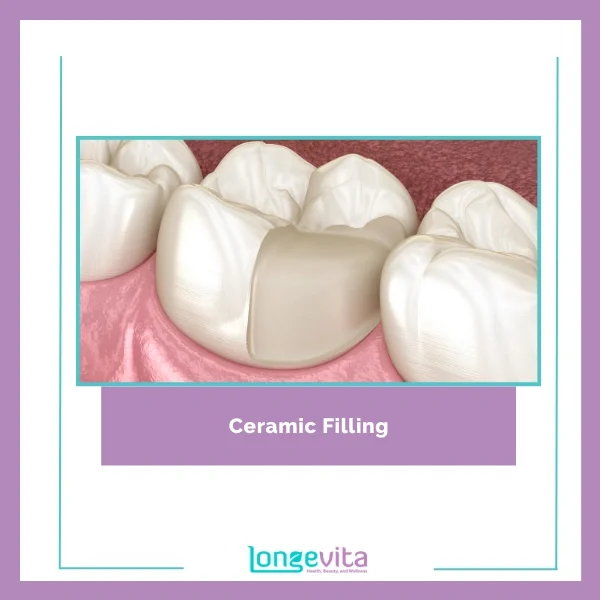 Ceramic Filling 1