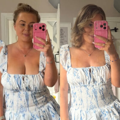 Chloe before and after 2