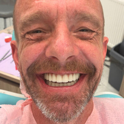 Colin with his new smile 1