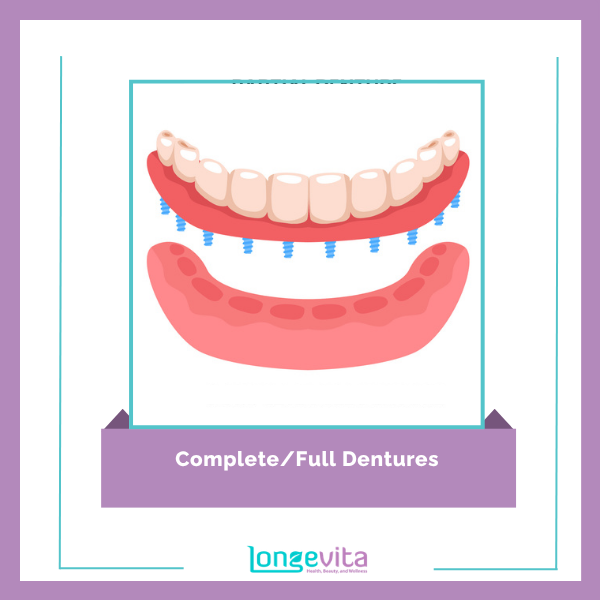 Dentures types 1