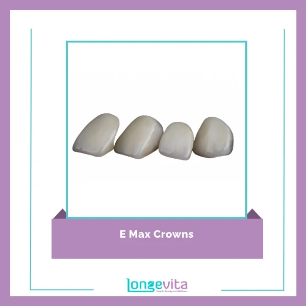 E Max Crowns