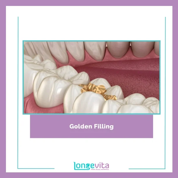 Golden Filling 1