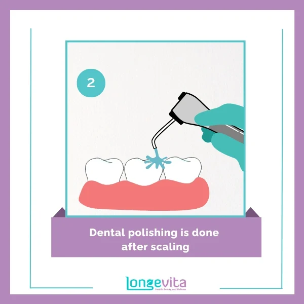 Scale polish procedure step 2