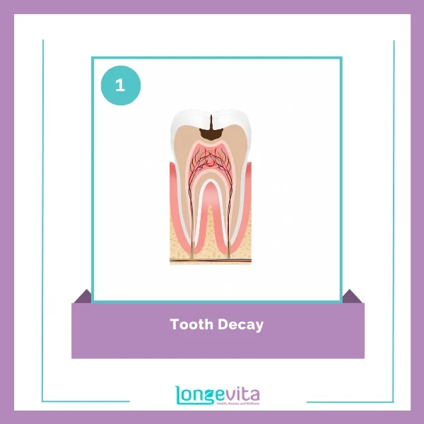 Tooth filling procedure 1